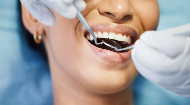 Best Broken or Cracked Tooth Emergency Dentist in Bolivar, OH
